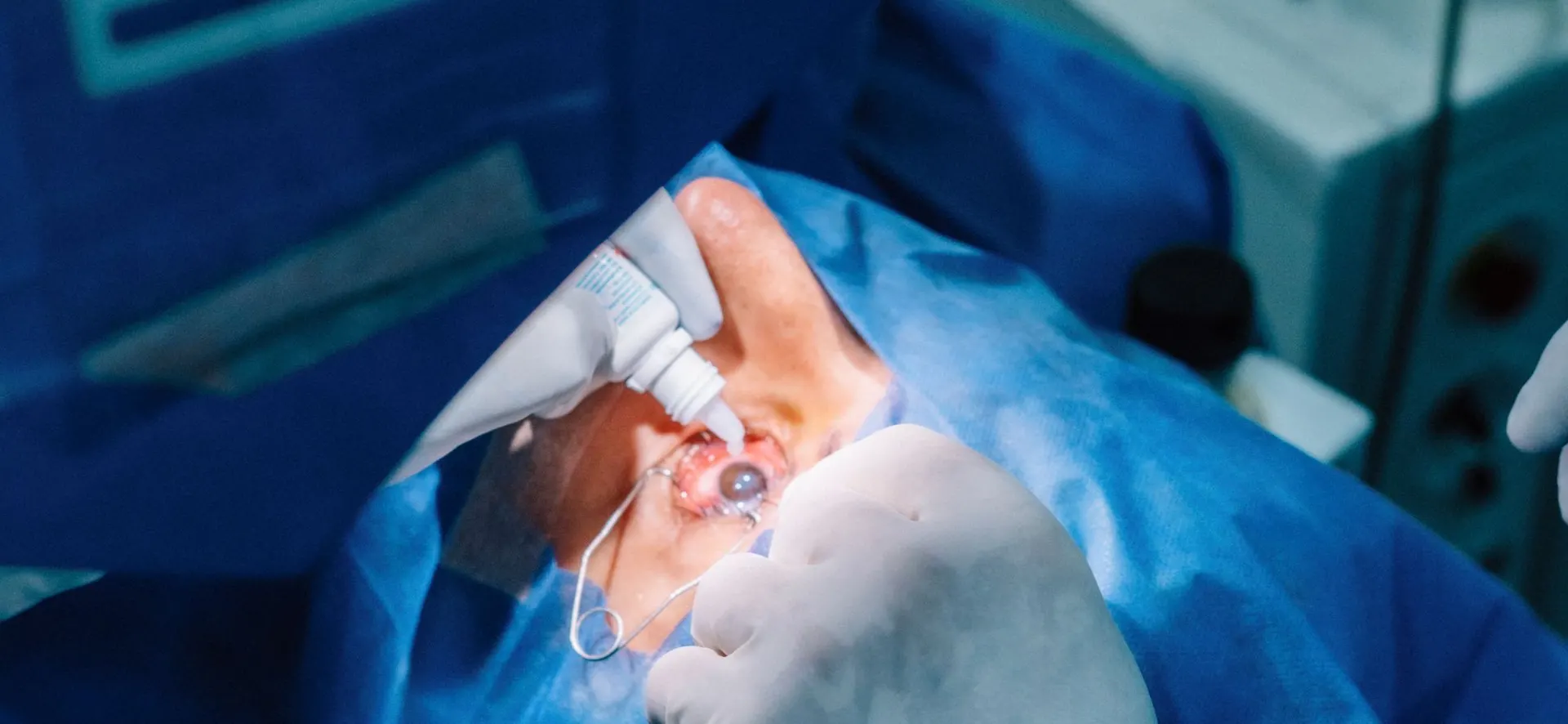 Cataract Surgery in Turkey