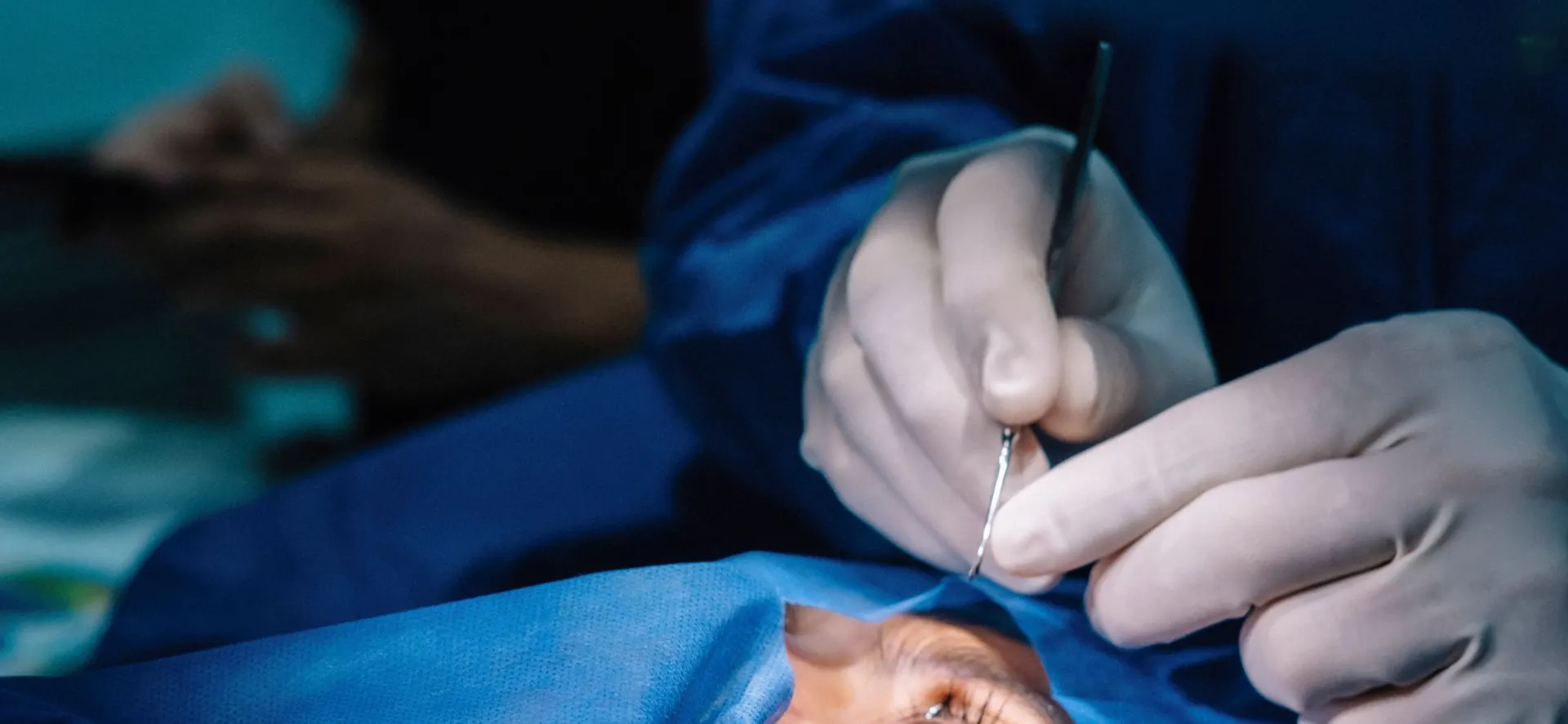 Corneal Transplant in Turkey