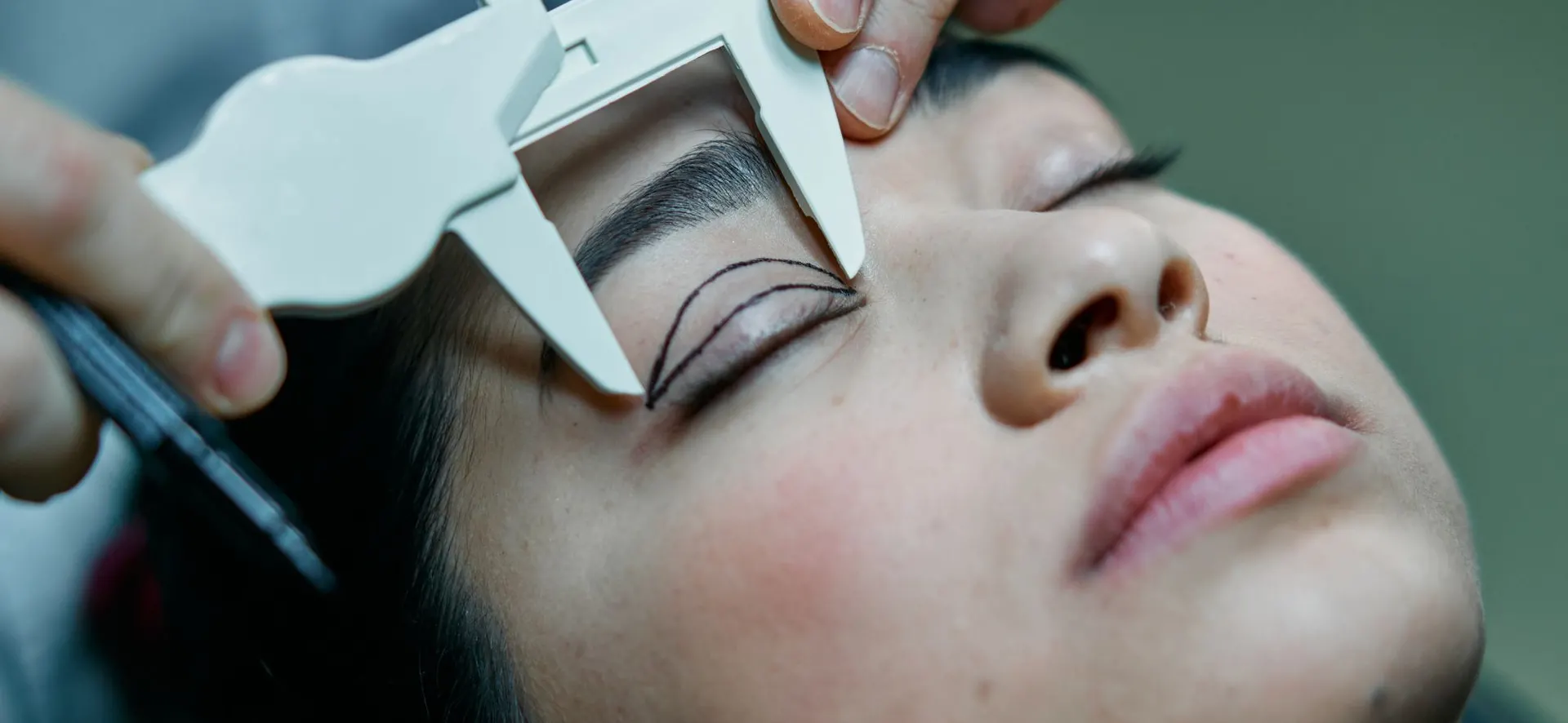 Lidstraffung (Blepharoplastik) in der Türkei