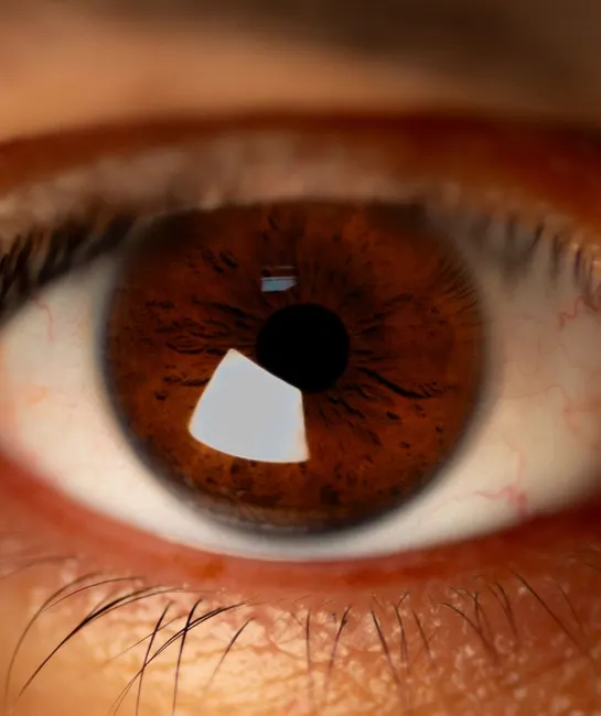 Who is a Good Candidate for IOL Surgery?
