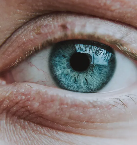 Why Choose Turkey for Pterygium Removal?