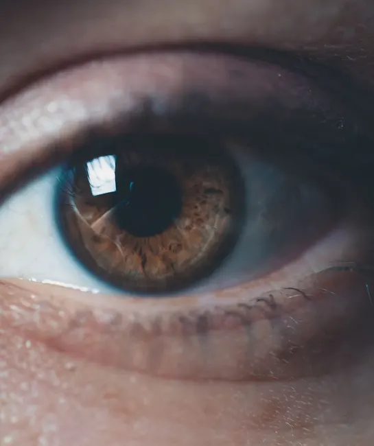 Toric Lenses for Astigmatism
