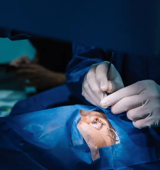 Step-by-Step Retina Surgery Procedure