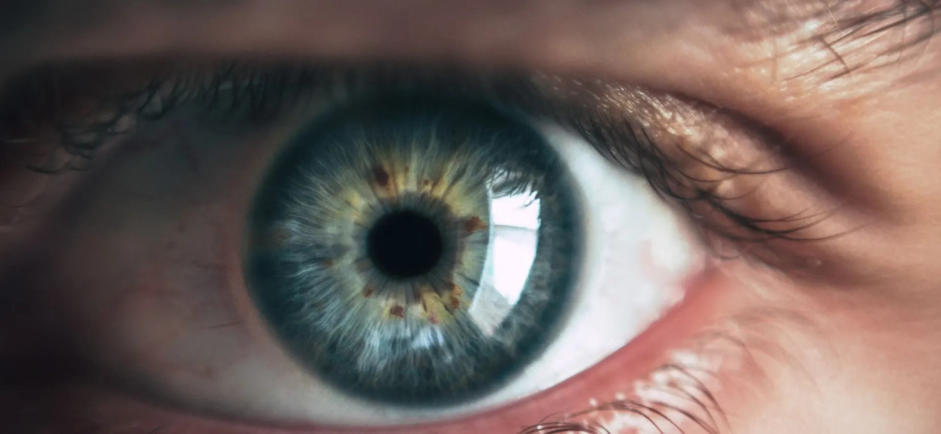Stem Cell Therapy for Eye Diseases in Turkey