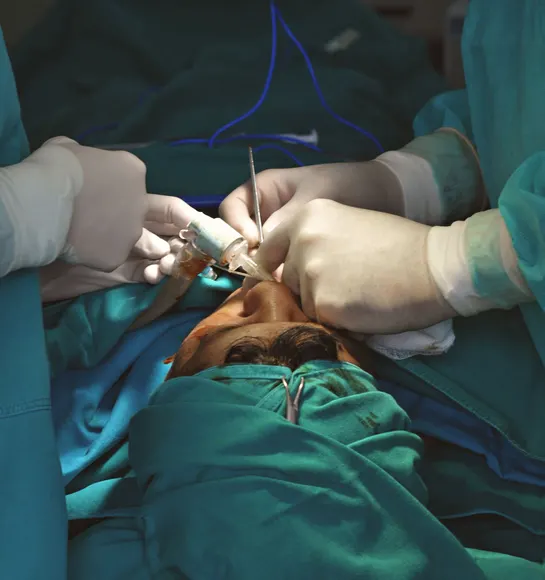 Step-by-Step Stem Cell Treatment Procedure