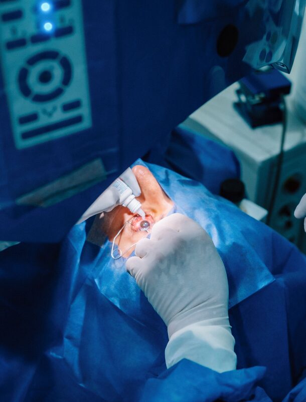 Cataract Surgery