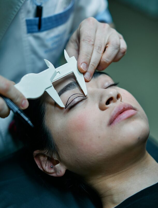 Eyelid Surgery (Blepharoplasty)