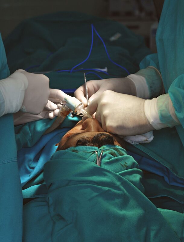 Ocular Surface Reconstruction