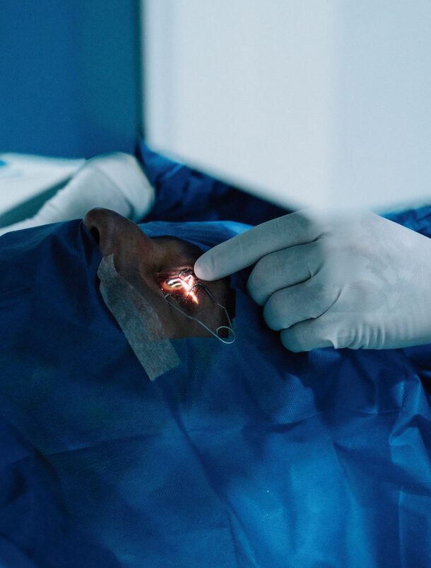 Pterygium Removal