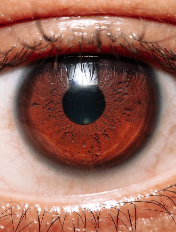 Uveitis Treatment